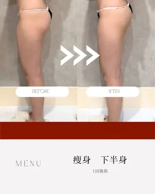 atelier design 【アトリエデザイン】所属・肌質・体質改善✖️ 小顔｜Rikaのエステ・リラクイメージ