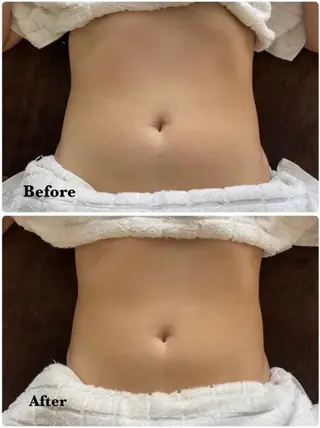 Salon Rosé 🌿漢方🌿足痩せのエステ・リラクイメージ