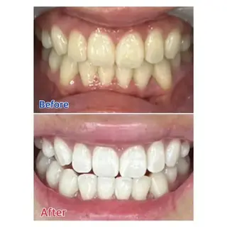 M渋谷店所属・M渋谷 ホワイトニングのエステ・リラクイメージ