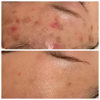 for woman所属・森 美優のエステ・リラクイメージ