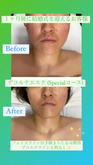 Bène Soin du Esthétique所属・逵中 元香のエステ・リラクイメージ