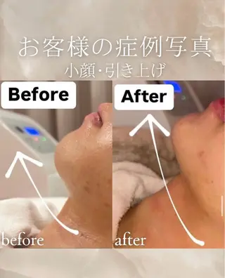 cpsalon ÉTOILE横浜馬車道店所属・ÉTOILE NATSUMIのエステ・リラクイメージ