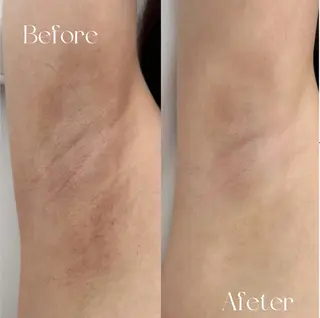 ニキビ/肌質改善専門 Snow skinのエステ・リラクイメージ