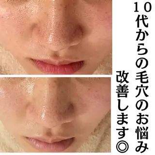 フェイシャル専門サロ ン　ERINのエステ・リラクイメージ