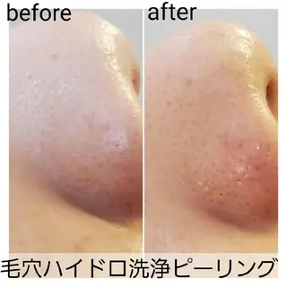 メンズ 小顔・美肌ケア専門 Diva北浜のエステ・リラクイメージ