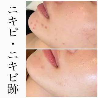 ハーブピーリング専門 BIOPLUS＋川崎のエステ・リラクイメージ