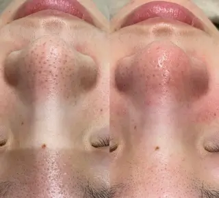 Sii センター北のエステ・リラクイメージ