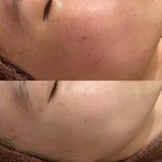 ニキビ・肌質改善専門 ♡人生が変わるサロンのエステ・リラクイメージ