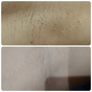 プライベートサロンマリン所属・Private Sa lon MARINEのエステ・リラクイメージ