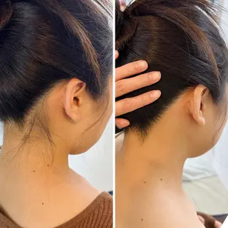 うなじ脱毛/美肌脱毛 LABELのエステ・リラクイメージ