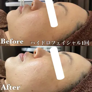 MINOA  大野城店所属・小林 千愛のエステ・リラクイメージ