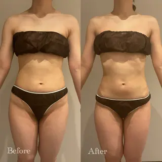 Esthetic MiEUXのエステ・リラクイメージ