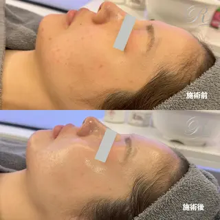 高橋 李奈のエステ・リラクイメージ