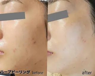 ASHERU* Yuiのエステ・リラクイメージ