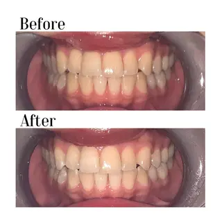 ホワイトニング|韓国式3D毛穴洗浄 lonhana ロンハナ所属・韓国式3D毛穴洗浄 lonhanaのその他イメージ