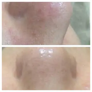 肌質改善美肌専門店 A-beautyのエステ・リラクイメージ