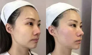 マツエク・マツパ aliaハイフ&水光ジェットサロン所属・aliaハーブ水光店 エステティシャン募集のエステ・リラクイメージ