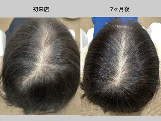 頭皮アンチエイジング L＋　秋葉原上野のエステ・リラクイメージ