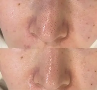 DeI'm   名古屋栄所属・小林 玲菜のエステ・リラクイメージ