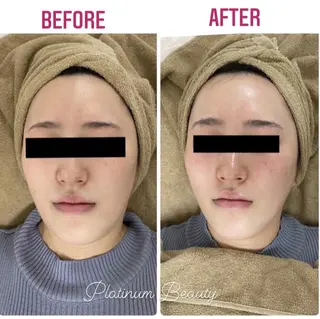 プラティーヌ ボーテ【もものり】のその他イメージ