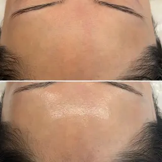 韓国🇰🇷価格 サロン_Nbibiのエステ・リラクイメージ