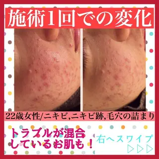 ミディアム カラー パーマ ヘアアレンジ メンズ キッズ ネイル マツエク・マツパ アイブロウ ニキビ・肌質改善専門 ♡人生が変わるサロンのエステ・リラクイメージ