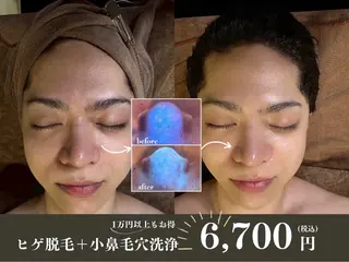 メンズ 🌸🧡六本木 脱毛しずか🧡🫧の眉毛・アイブロウイメージ