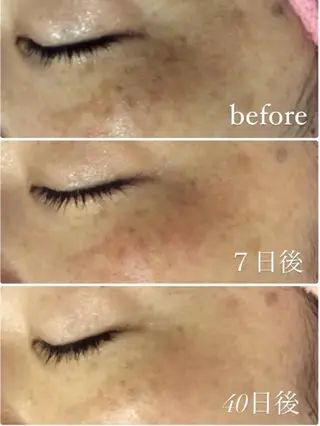 RAY Beauty エステ　一宮店のエステ・リラクイメージ