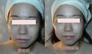 genese beauteのエステ・リラクイメージ