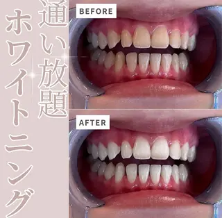 セルフホワイトニングサロン エクシア江坂店所属・セルフホワイトニング エクシア江坂店のエステ・リラクイメージ