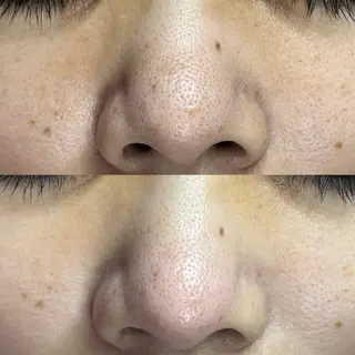 毛穴ケア・ヘッドスパサロンSHINY(シャイニー)所属・毛穴ケア・ヘッドスパ サロンSHINYのエステ・リラクイメージ