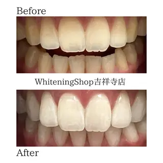 ホワイトニング ショップ吉祥寺店のエステ・リラクイメージ