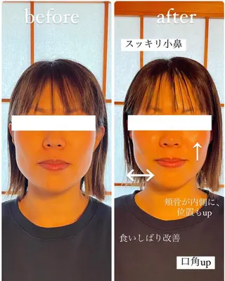 自律神経を整える フェイシャルエステのエステ・リラクイメージ