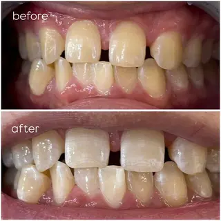 エクシア津駅前店所属・セルフホワイトニング エクシア津駅前店のその他イメージ