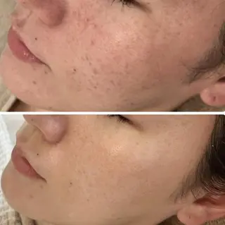 MiMiy 銀座店のエステ・リラクイメージ