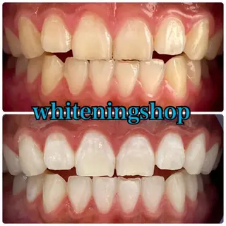 ホワイトニング ショップ吉祥寺店のエステ・リラクイメージ