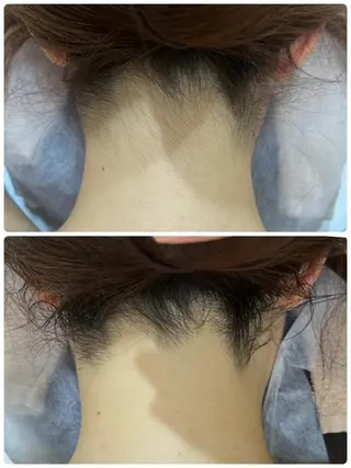 レイビス 渋谷店のエステ・リラクイメージ