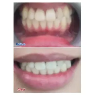 M渋谷店所属・M渋谷 ホワイトニングのエステ・リラクイメージ