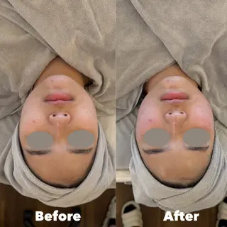 東京オンダリフト・よもぎ蒸し専門 恵比寿店所属・恵比寿 オンダリフト 小顔ケアのエステ・リラクイメージ