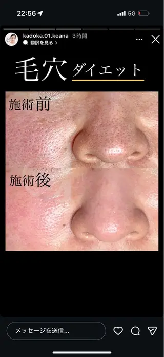 akasha所属・渡部 ゆみのエステ・リラクイメージ