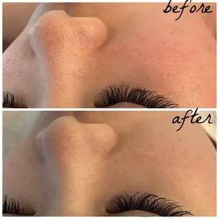 メンズ メナード岐阜市茜部 杉浦のエステ・リラクイメージ