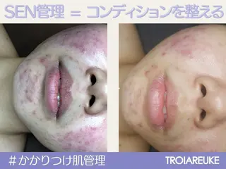 salonCOCO所属・肌管理看護師💎 salonCOCOのエステ・リラクイメージ