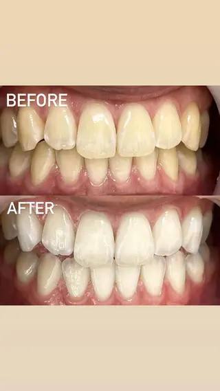 LBSホワイトニング 銀座店💎店長浦和のその他イメージ