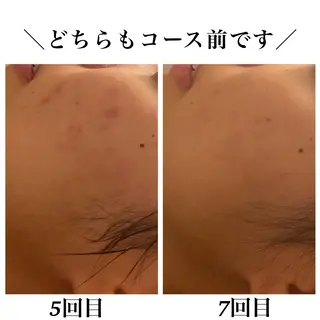 Bellesthe （ベルエステ）のエステ・リラクイメージ