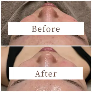 ハーブピーリング専門 muro.のエステ・リラクイメージ