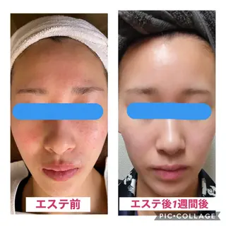 ナリスビューティーサロンつくば店所属・バストアップサロン -Sirius-かずのエステ・リラクイメージ