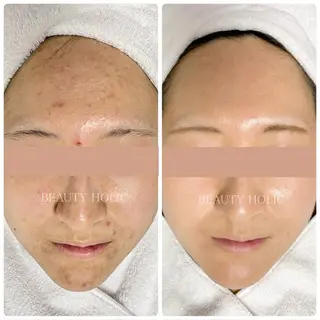 ビューティーホリック 東金店のエステ・リラクイメージ