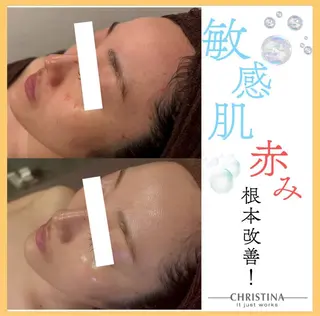 🎀葛野 日向子🎀のエステ・リラクイメージ