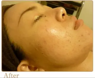 ピーリングサロン シャンテールのエステ・リラクイメージ