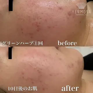 温活未病ケアサロン CoQのエステ・リラクイメージ